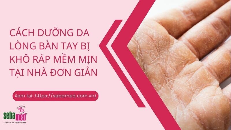 7 Cách dưỡng da lòng bàn tay bị khô ráp nhanh mềm mịn tại nhà đơn giản