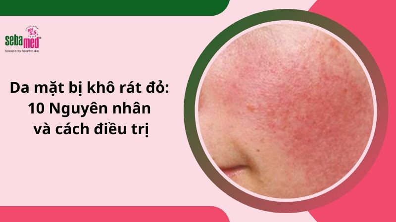 Da mặt bị khô rát đỏ: 10 Nguyên nhân và cách xử lý