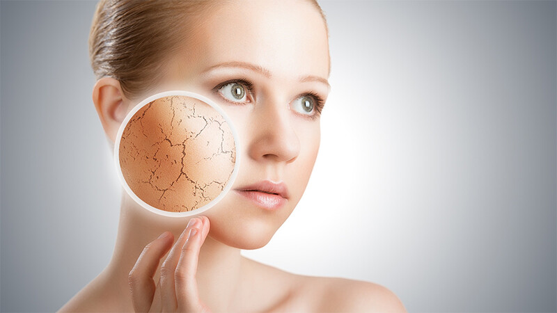 Vì sao da mặt khô rát đỏ vào mùa đông?