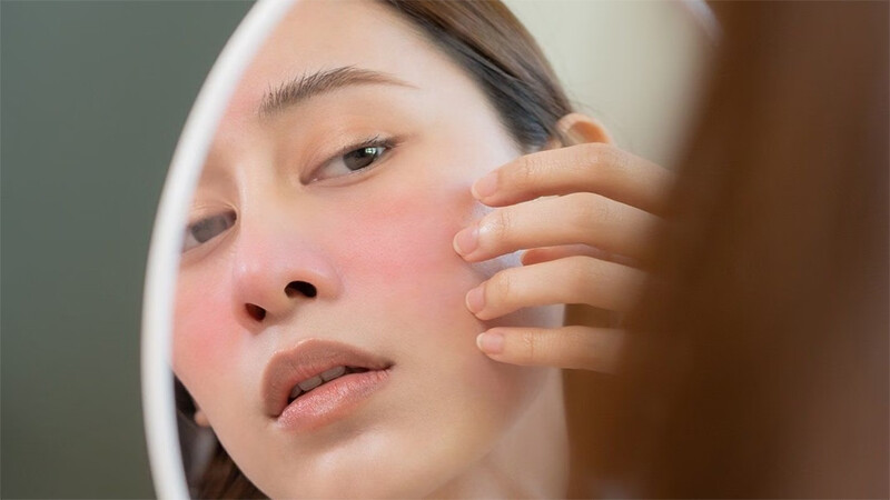 Dấu hiệu nhận biết da mặt bị khô nẻ mùa đông.