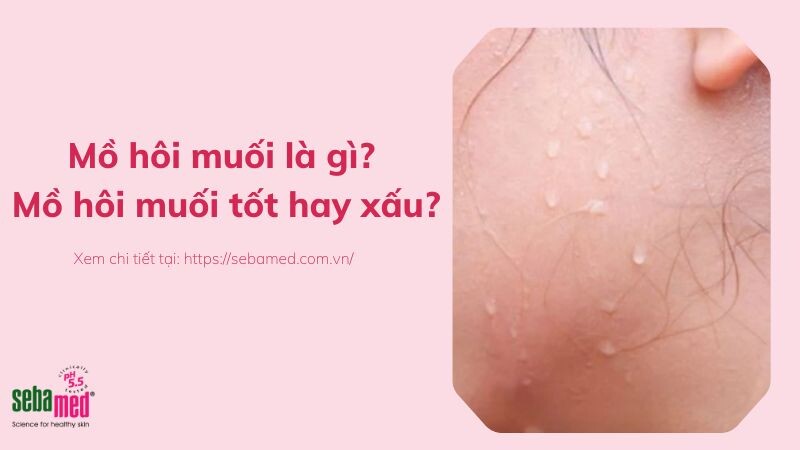 Mồ hôi muối là gì? Mồ hôi muối tốt hay xấu?