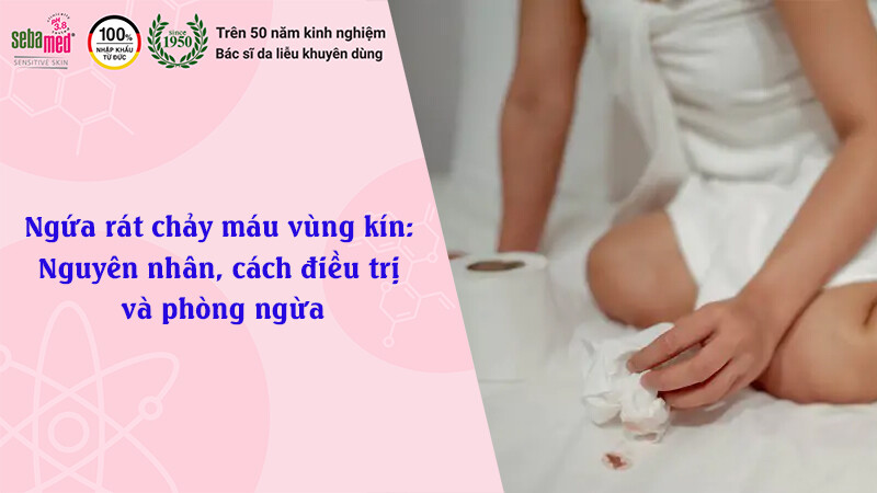 Ngứa rát chảy máu vùng kín: Nguyên nhân, cách điều trị và phòng ngừa