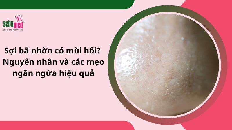 Sợi bã nhờn có mùi hôi? 6 Nguyên nhân có thể bạn chưa biết