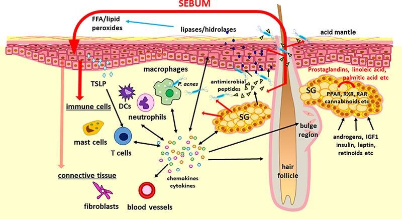 Quá trình hình thành sợi bã nhờn có mùi hôi trên da đầu.