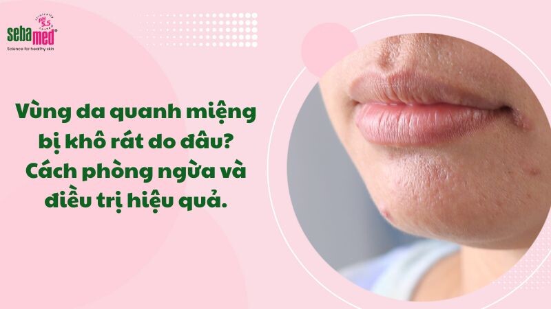 Vùng da quanh miệng bị khô rát do đâu? Cách trị hiệu quả tại nhà
