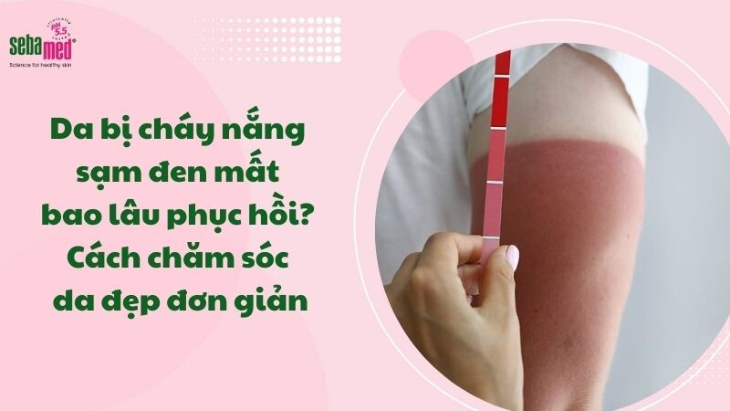 Da bị cháy nắng sạm đen mất bao lâu phục hồi? Cách chăm sóc da đẹp đơn giản