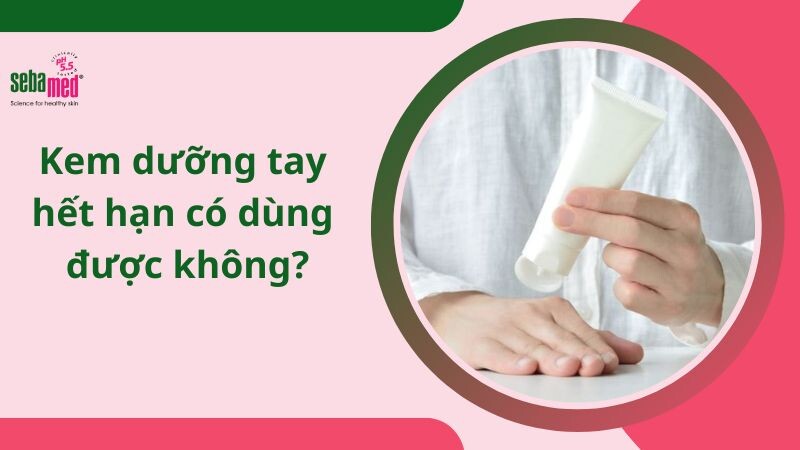 Kem dưỡng tay hết hạn có dùng được không? Giải đáp 2026