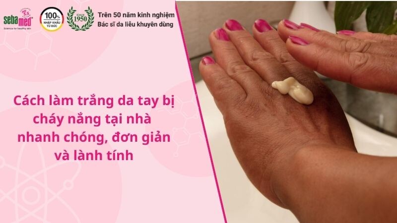 Cách làm trắng da tay bị cháy nắng tại nhà nhanh chóng, đơn giản và lành tính