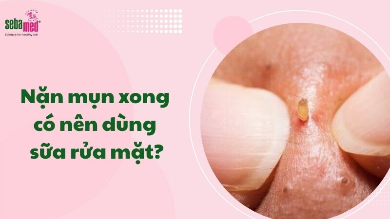 Nặn mụn xong có nên dùng sữa rửa mặt? Giải đáp từ các chuyên gia 2026