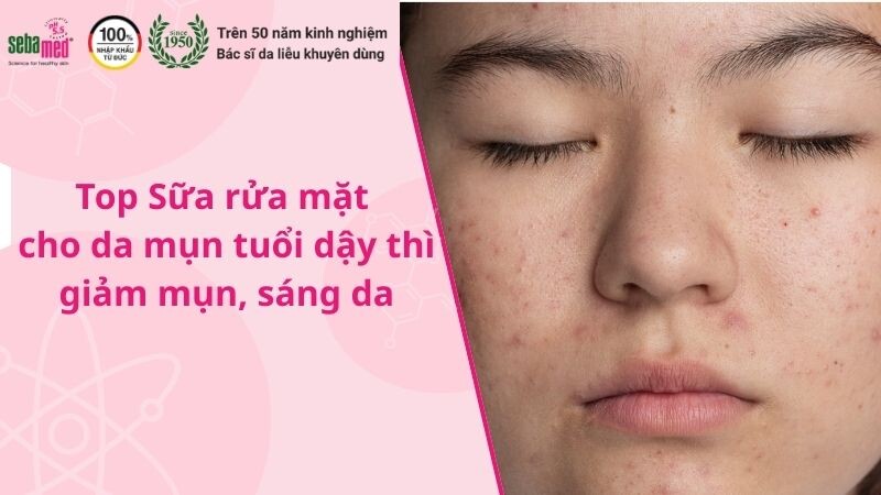 Top 10 Sữa rửa mặt cho da mụn tuổi dậy thì giảm mụn, sáng da