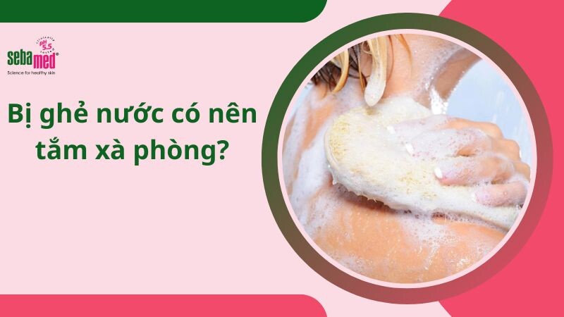 Bị ghẻ nước có nên tắm xà phòng?