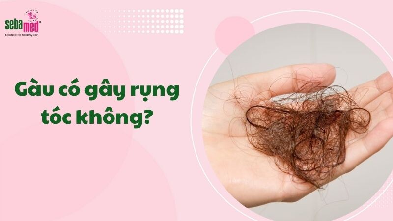 Gàu có gây rụng tóc không?