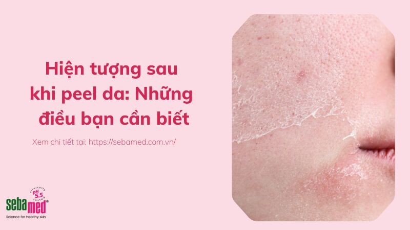 Hiện tượng sau khi peel da: Những điều bạn cần biết
